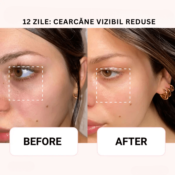 AXIS - Y Ser Korean 6+1+1 | Aplicator CoolTouch Eye Monbelle