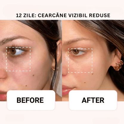 AXIS - Y Ser Korean 6+1+1 | Aplicator CoolTouch Eye Monbelle