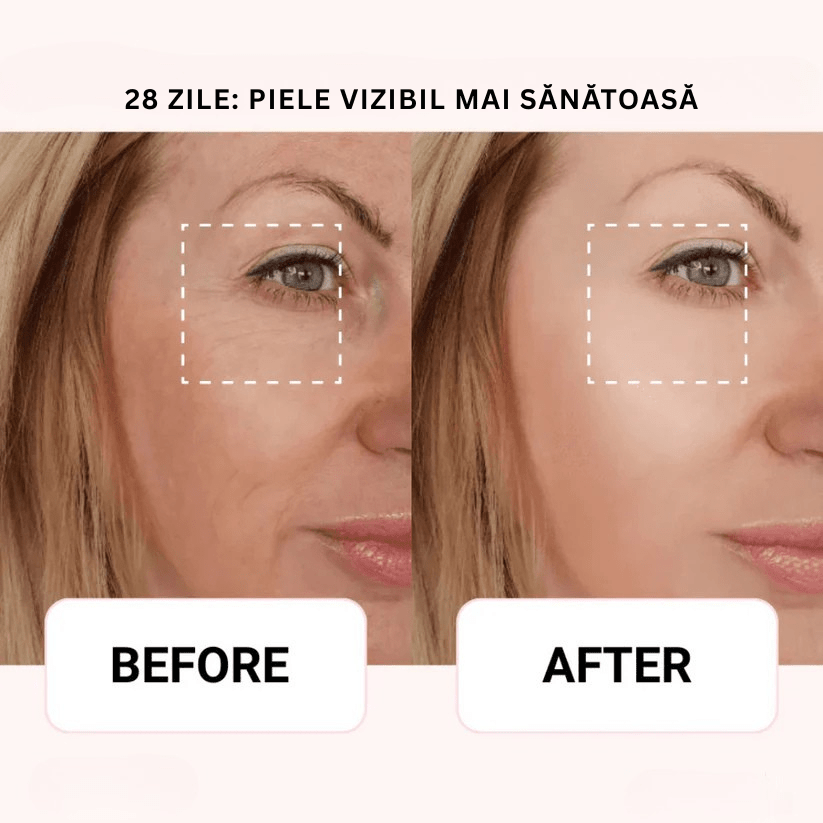 AXIS - Y Ser Korean 6+1+1 | Aplicator CoolTouch Eye Monbelle