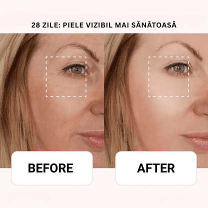 AXIS - Y Ser Korean 6+1+1 | Aplicator CoolTouch Eye Monbelle