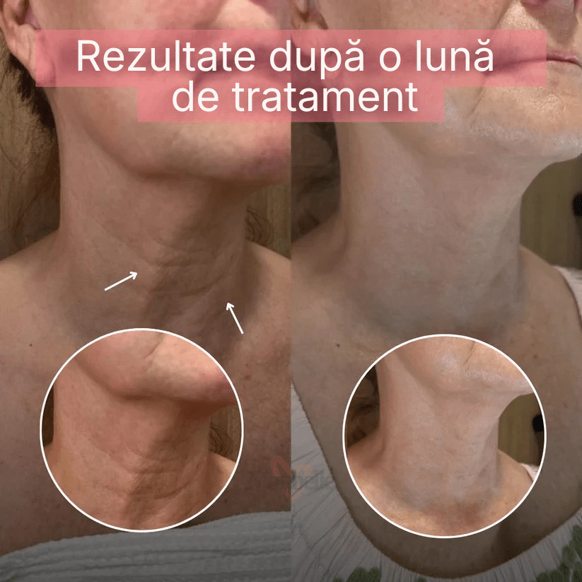 Mască profesională pentru gât - made in Korea Monbelle