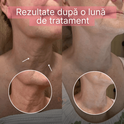 Mască profesională pentru gât - made in Korea Monbelle