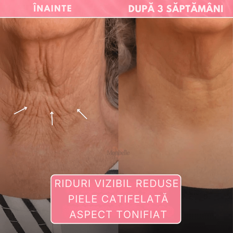 Mască profesională pentru gât - made in Korea Monbelle